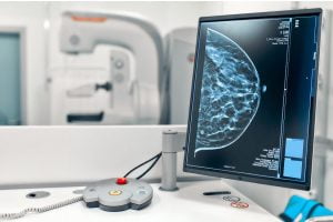 Biópsia tardia agrava o tratamento do câncer de mama, alerta Sociedade Brasileira de Mastologia
