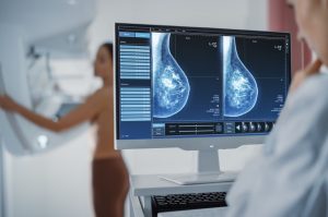 Dasa revela que 2,1% das mamografias feitas em 2022 tiveram alteração e que pacientes deixaram para realizar o exame nos últimos 3 meses do ano