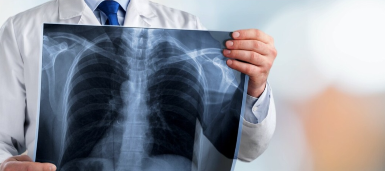 SPR promove desafio global de IA para aprimorar análise de mamografias