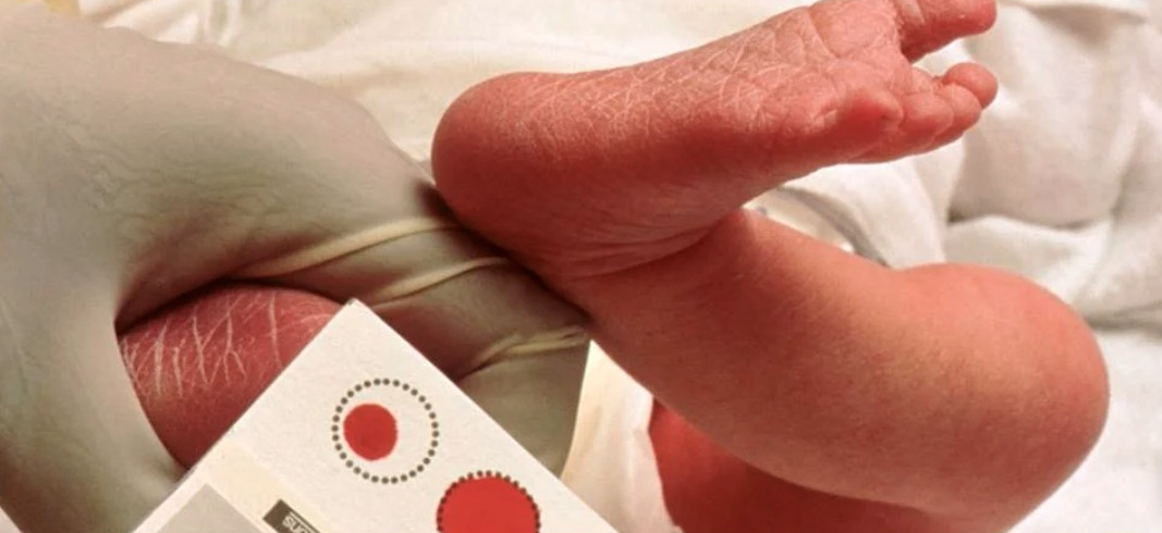 OMS faz chamado para ampliação do teste do pezinho e SBTEIM reforça cinco prioridades para a Triagem Neonatal brasileira
