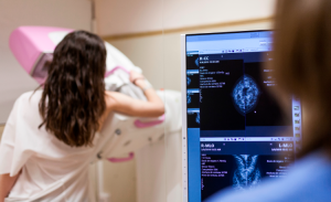 Mamografia digital passa a ter cobertura sem restrição de idade ou gênero