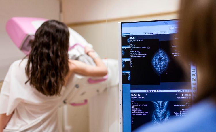 Mamografia digital passa a ter cobertura sem restrição de idade ou gênero